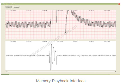 Memory Playback includes ECG, grid, speech waveform, corresponding time mark, Auto play button, and button for printing current page. 