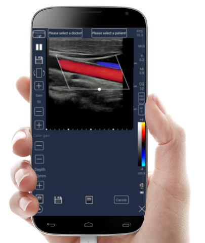 Meditech tablet ultrasound scanner, color doppler,android doppler,iphone ultrasound scanner