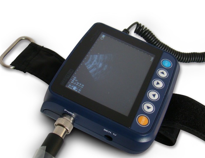 miniScan ultrasound